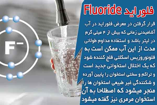 فلوراید Fluoride در آب آشامیدنی
